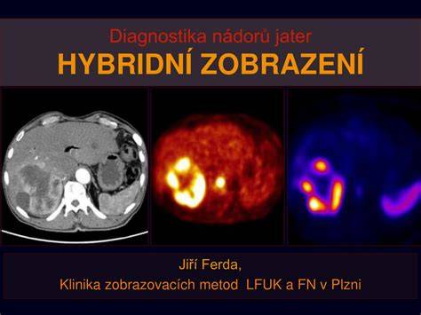 Diagnostika nádorů v těhotenství
