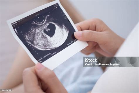 těhotná žena na masážním lehátku